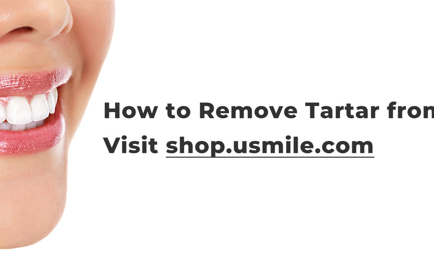 How to Remove Tartar from Teeth at Home? - usmile