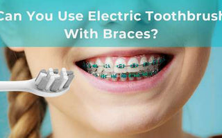 Can You Use Electric Toothbrush With Braces? - usmile